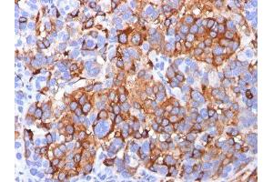 Image no. 1 for anti-Melan A (MLANA) antibody (ABIN6173195) (MLANA antibody)