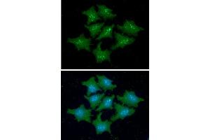 ICC/IF analysis of FKBP14 in HeLa cells line, stained with DAPI (Blue) for nucleus staining and monoclonal anti-human FKBP14 antibody (1:100) with goat anti-mouse IgG-Alexa fluor 488 conjugate (Green). (FKBP14 antibody)