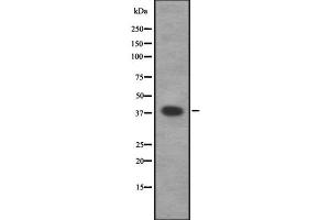 Western blot analysis of CAMK1 using Jurkat whole  lysates. (CAMK1 antibody  (Internal Region))