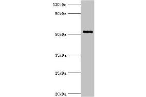 Western blot All lanes: Interleukin-1 receptor-associated kinase 4 antibody at 4 μg/mL + Jurkat whole cell lysate Secondary Goat polyclonal to rabbit IgG at 1/10000 dilution Predicted band size: 52, 38 kDa Observed band size: 52 kDa (IRAK4 antibody  (AA 1-220))