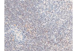 ABIN6267285 at 1/100 staining mouse spleen tissue sections by IHC-P. (ErbB2/Her2 antibody  (pTyr1112))