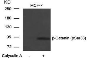 Image no. 1 for anti-Catenin (Cadherin-Associated Protein), beta 1, 88kDa (CTNNB1) (pSer33) antibody (ABIN196956) (CTNNB1 antibody  (pSer33))