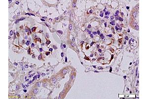 Formalin-fixed and paraffin embedded rat kidney tissue with Anti-Megsin Polyclonal Antibody, Unconjugated (ABIN728548) at 1:200, followed by conjugation to the secondary antibody and DAB staining
