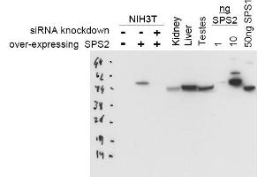 Image no. 1 for anti-Selenophosphate Synthetase 2 (SEPHS2) antibody (ABIN401044) (SEPHS2 antibody)