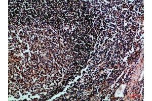 Immunohistochemical analysis of paraffin-embedded Human-tonsil, antibody was diluted at 1:100 (HLA-DMB antibody  (AA 40-100))