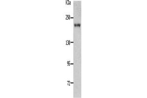 Western Blotting (WB) image for anti-Nephrosis 1, Congenital, Finnish Type (Nephrin) (NPHS1) antibody (ABIN2431713) (Nephrin antibody)