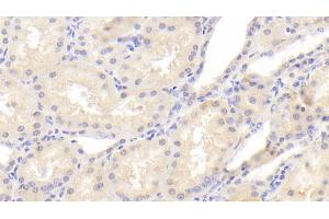 Detection of PCNT in Human Kidney Tissue using Polyclonal Antibody to Pericentrin (PCNT) (PCNT antibody  (AA 2987-3246))
