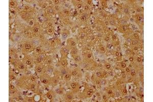 IHC image of ABIN7127533 diluted at 1:125 and staining in paraffin-embedded human liver tissue performed on a Leica BondTM system. (Recombinant GSTO1 antibody)
