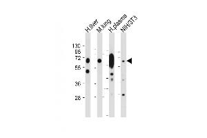 All lanes : Anti-LGALS3BP Antibody (Center) at 1:2000 dilution Lane 1: Human liver tissue lysate Lane 2: Mouse lung tissue lysate Lane 3: Human plasma tissue lysate Lane 4: NIH/3T3 whole cell lysate Lysates/proteins at 20 μg per lane. (LGALS3BP antibody  (AA 383-412))