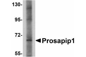 Image no. 1 for anti-ProSAP-Interacting Protein 1 (PROSAPIP1) (C-Term) antibody (ABIN478164) (ProSAPiP1 antibody  (C-Term))