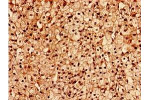 Immunocytochemistry analysis of human adrenal gland tissue using ABIN7153269 at dilution of 1:100 (FGD6 antibody  (AA 1138-1352))