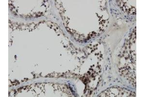 Image no. 1 for anti-PDZ Binding Kinase (PBK) (AA 1-110) antibody (ABIN599274) (PBK antibody  (AA 1-110))