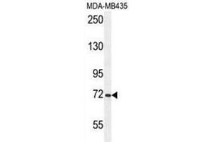 ARHGAP10 Antibody (Center) western blot analysis in MDA-MB435 cell line lysates (35µg/lane). (ARHGAP10 antibody  (Middle Region))