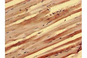 Immunohistochemistry (IHC) image for anti-Protein Phosphatase 1, Regulatory Subunit 3B (PPP1R3B) (AA 1-285), (Regulatory Subunit 3B) antibody (ABIN7165933)