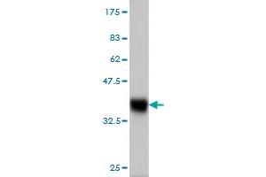 Western Blot detection against Immunogen (36. (CLLD6 antibody  (AA 97-196))