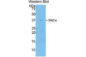 Detection of Recombinant GAD2, Human using Polyclonal Antibody to Glutamate Decarboxylase 2 (GAD2) (GAD65 antibody  (AA 65-105))