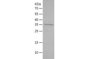 Western Blotting (WB) image for Proteolipid Protein 1 (PLP1) (AA 2-277) protein (His tag) (ABIN7124694) (PLP1 Protein (AA 2-277) (His tag))