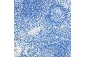 (ABIN5539622) Negative Control showing staining of paraffin embedded Human Tonsil, with no primary antibody. (c-FOS antibody  (AA 283-295))