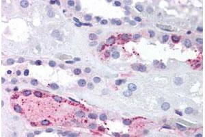 Immunohistochemical (Formalin/PFA-fixed paraffin-embedded sections) staining in human kidney with LPAR4 polyclonal antibody . (LPAR4 antibody  (C-Term))