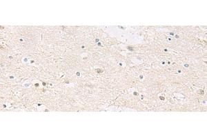 Immunohistochemistry of paraffin-embedded Human brain tissue using ANKS6 Polyclonal Antibody at dilution of 1:55(x200) (ANKS6 antibody)