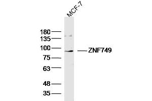 MCF-7 lysates probed with ZNF749 Polyclonal Antibody, Unconjugated  at 1:300 dilution and 4˚C overnight incubation. (ZNF749 antibody  (AA 151-250))