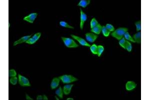Immunofluorescence staining of Hela cells with ABIN7142520 at 1:100, counter-stained with DAPI. (RPS23 antibody  (AA 2-143))