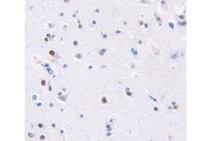 Used in DAB staining on fromalin fixed paraffin- embedded Kidney tissue (Arx antibody  (AA 25-246))