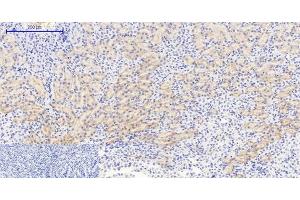 Immunohistochemistry (Paraffin-embedded Sections) (IHC (p)) image for anti-Nuclear Factor of kappa Light Polypeptide Gene Enhancer in B-Cells Inhibitor, alpha (NFKBIA) (pSer32), (pSer36) antibody (ABIN7250746)