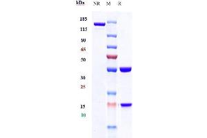 Anti-IFNg Reference Antibody (fontolizumab) on SDS-PAGE under reducing (R) condition. (Recombinant IFNG (Fontolizumab Biosimilar) antibody)