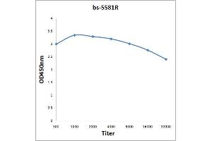 Antigen: 0. (PIK3C3 antibody  (pSer164))