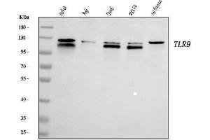 Western blot analysis of TLR9 using anti-TLR9 antibody (ABIN7602935).