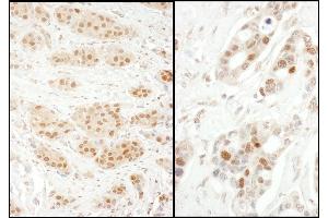 anti-Exportin 5 (XPO5) (AA 1154-1204) antibody