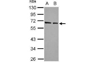 WB Image Sample (30 ug of whole cell lysate) A: A549 B: HeLa 10% SDS PAGE antibody diluted at 1:5000 (KLF4 antibody  (C-Term))