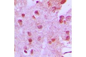 Immunohistochemistry (IHC) image for anti-Multiple Endocrine Neoplasia 1 (MEN1) (Center) antibody (ABIN7296286)