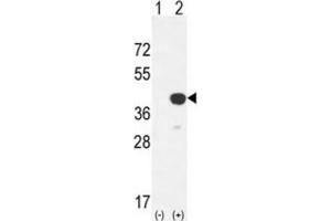 Western Blotting (WB) image for anti-Cathepsin K (CTSK) antibody (ABIN3003176) (Cathepsin K antibody)