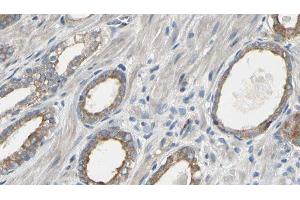 ABIN6277566 at 1/100 staining Human prostate tissue by IHC-P. (EEF2K antibody  (Internal Region))