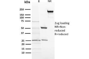 SDS-PAGE Analysis Purified ACTH Mouse Monoclonal Antibody (57). (POMC antibody  (N-Term))