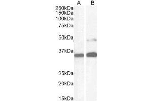 ABIN184783 (1µg/ml) staining of Human Kidney (A) and HeLa cell (B) lysate (35µg protein in RIPA buffer).