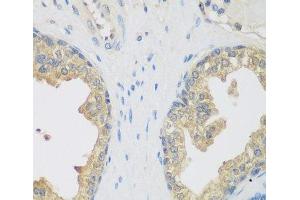 Immunohistochemistry of paraffin-embedded Human prostate using ENPEP Polyclonal Antibody at dilution of 1:200 (40x lens). (ENPEP antibody)