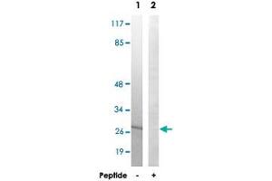 Western blot analysis of extracts from 293 cells, using MRPL16 polyclonal antibody .