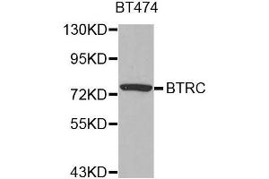Western blot analysis of extracts of BT474 cell line, using BTRC antibody.