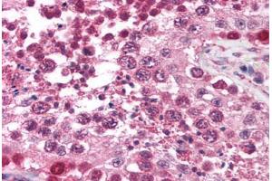 Human Testis (formalin-fixed, paraffin-embedded) stained with TRIM17 antibody ABIN213719 at 2. (TRIM17 / RNF16 antibody  (AA 254-303))