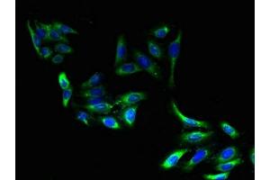 Immunofluorescent analysis of HepG2 cells using ABIN7151560 at dilution of 1:100 and Alexa Fluor 488-congugated AffiniPure Goat Anti-Rabbit IgG(H+L) (ELOVL2 antibody  (AA 91-174))