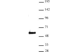 Western Blotting (WB) image for anti-SWI/SNF Related, Matrix Associated, Actin Dependent Regulator of Chromatin, Subfamily E, Member 1 (SMARCE1) (C-Term) antibody (ABIN6972749)
