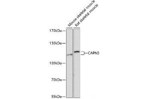 Western blot analysis of extracts of various cell lines using CAPN3 Polyclonal Antibody at dilution of 1:3000. (Calpain 3 antibody)