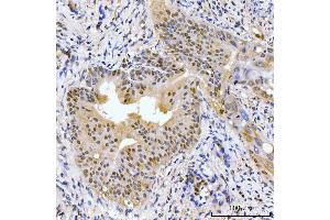 IHC analysis of AKAP 95/AKAP8 using anti-AKAP 95/AKAP8 antibody (ABIN7601553). (AKAP8 antibody  (AA 380-546))