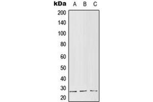 Western blot analysis of RGS5 expression in MCF7 (A), Raw264. (RGS5 antibody  (Center))