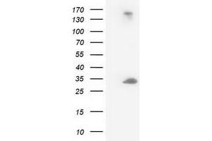 HEK293T cells were transfected with the pCMV6-ENTRY control (Left lane) or pCMV6-ENTRY DCK (Right lane) cDNA for 48 hrs and lysed. (DCK antibody)