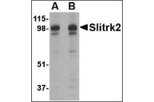 Western blot analysis of Slitrk2 in rat brain tissue lysate with this product at (A) 1 and (B) 2 μg/ml.