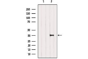 Western Blotting (WB) image for anti-Nuclear Factor of kappa Light Polypeptide Gene Enhancer in B-Cells Inhibitor, alpha (NFKBIA) (C-Term) antibody (ABIN6262505)
